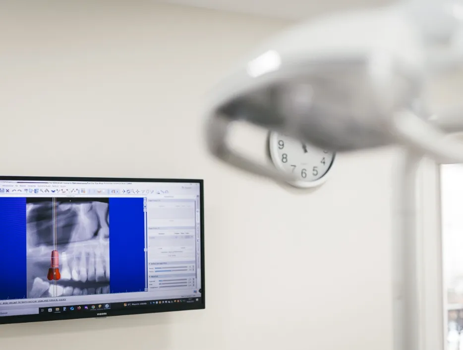 Radiografía de un implante dental en la pantalla de un gabinete de la Clínica Dental Moaña